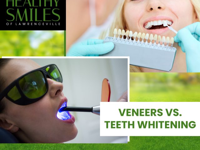 Veneers vs. Teeth Whitening: Which is Right for You? (featured image)